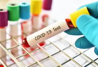 Coronavirus: Confirman primer caso de covid-19 en Costa Rica