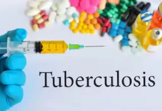 Vacuna contra tuberculosis podría ser útil contra coronavirus, según Nobel nipón