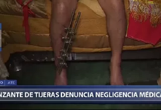 Cayetano Heredia: Danzante de tijeras denunció negligencia médica en el hospital