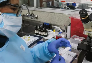 Minsa: El país tiene 100 laboratorios para el diagnóstico molecular de la COVID-19