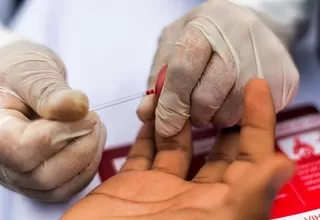 Minsa afirma que Perú redujo mortalidad por VIH/Sida en casi 40% en los últimos diez años