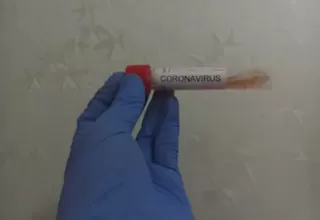 Estados Unidos: Confirman primer caso de coronavirus en San Diego