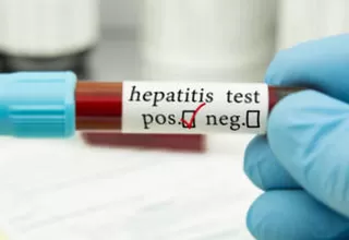 OMS confirma aumento de casos de la nueva hepatitis infantil aguda
