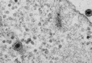 Brasil: Descubren el Yaravirus, un misterioso virus que intriga a los científicos