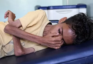 Yemen: 85.000 niños han muerto de hambre en los últimos cuatro años