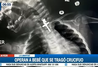 La Libertad: Médicos operaron con éxito a bebé que tragó crucifijo de metal